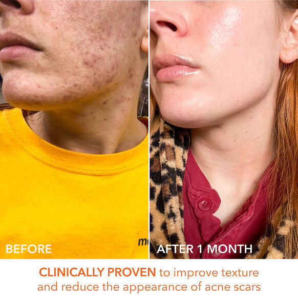 Dr Dennis Gross Skincare Alpha Beta Universal Daily Peel