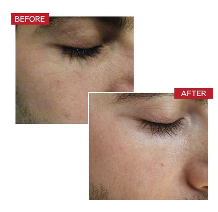 Dr. Levy Switzerland Booster Serum — Mini size 7 ml