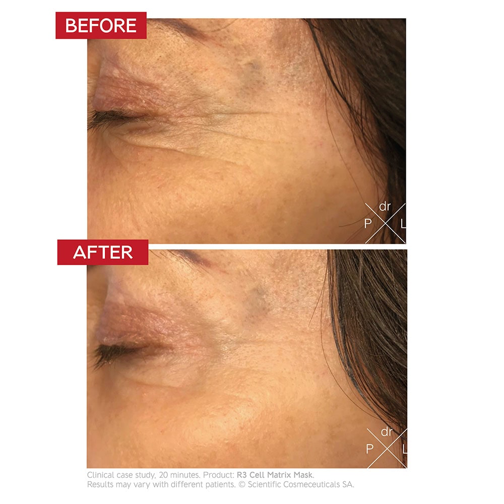 DR. Levy R3 Cell Matrix Mask — Full Size 50 ml