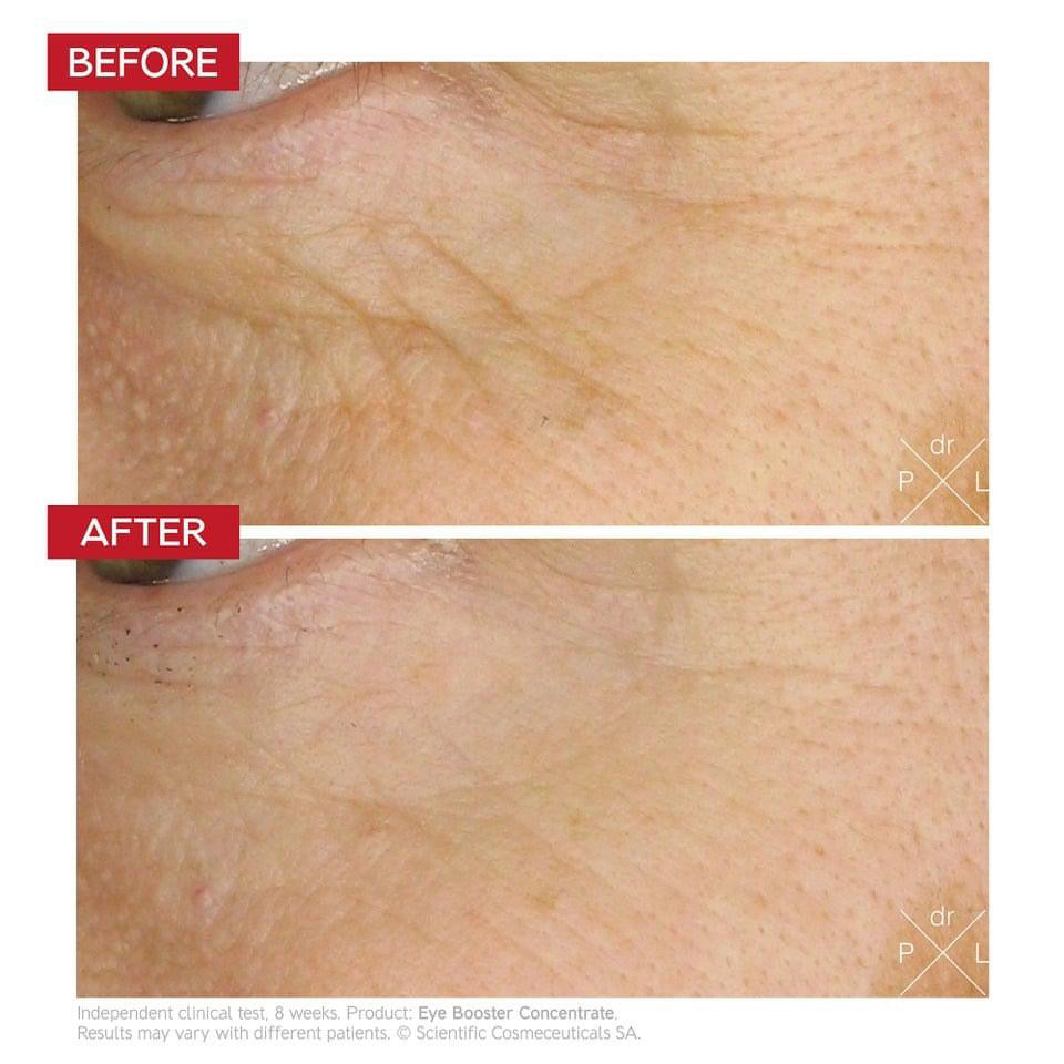 Dr. Levy Switzerland Eye Booster Concentrate — Mini Size 7 ml