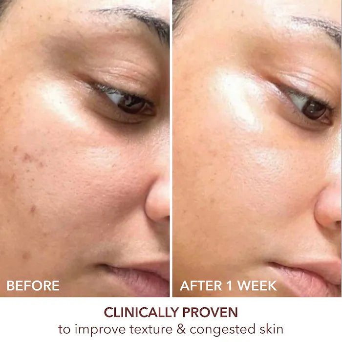 Dr. Dennis Gross Advanced Retinol + Ferulic Texture Renewal Serum — Travel Size 7 ml
