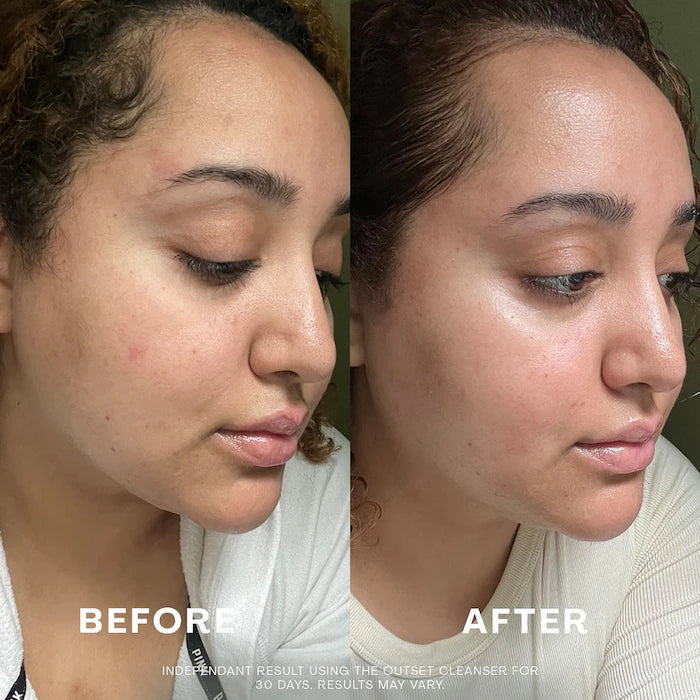 The Outset Gentle Micellar Antioxidant Cleanser — Travel Size 15 ml