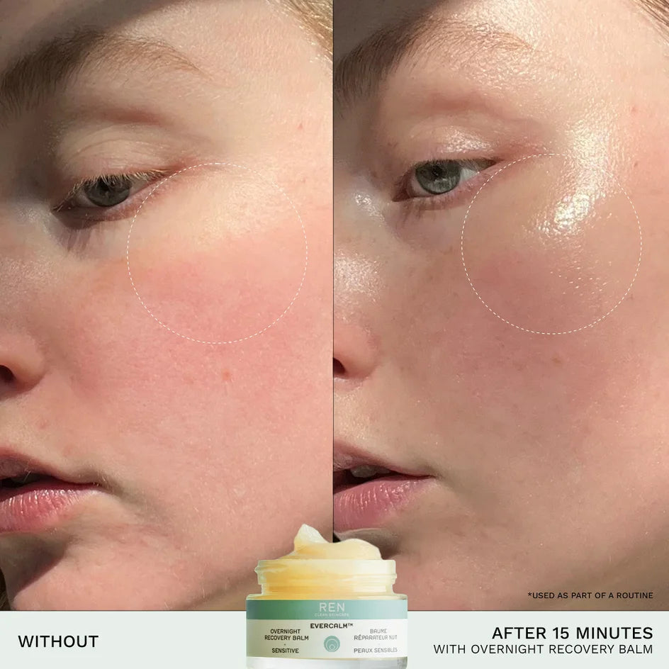 REN Clean Skincare - Evercalm Overnight Recovery Balm — Full Size 30ml