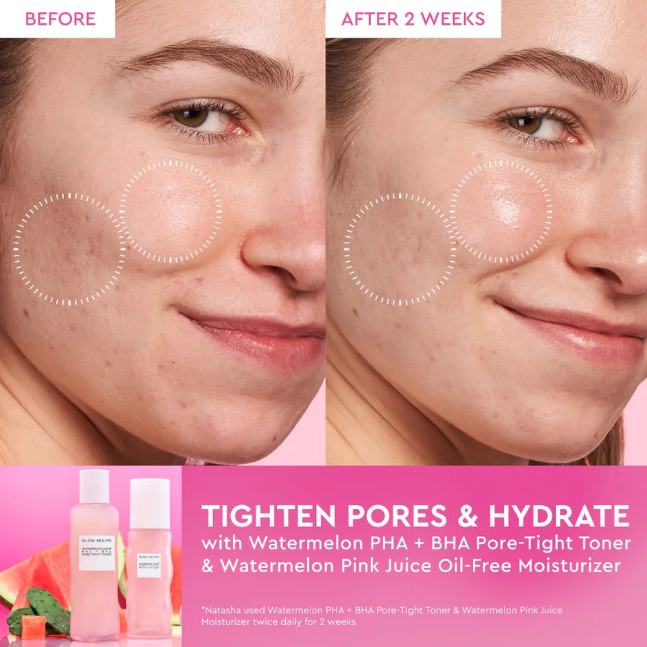 Glow Recipe Watermelon Glow Pink Juice Moisturiser — Travel Size 15 ml