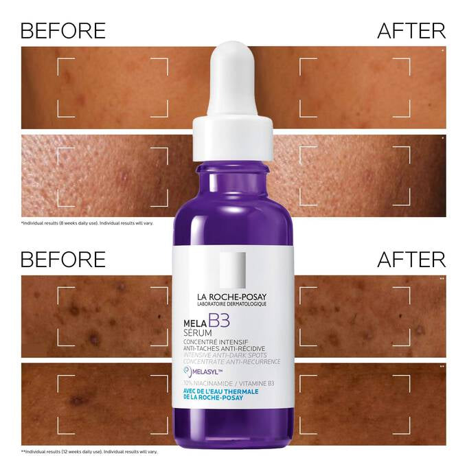 La Roche-Posay MELA B3 Anti-Dark Spot Serum for Hyperpigmentation — Mini Size 10 ml