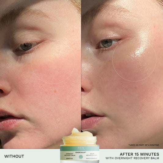 REN Clean Skincare - Evercalm Overnight Recovery Balm — Full Size 30ml