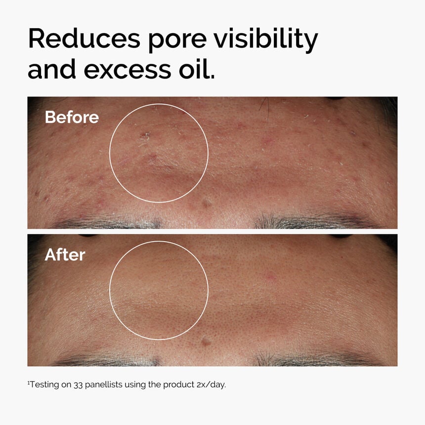 The Ordinary Niacinamide 10% + Zinc 1% — Full Size